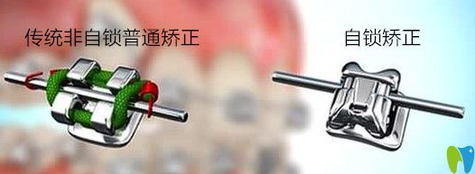 自鎖與非自鎖區(qū)別