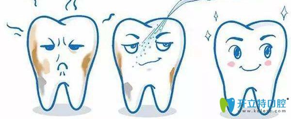 泰州北極星牙齒洗白后的圖片