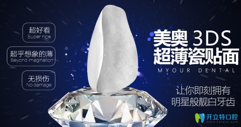 美奧口腔牙齒貼面價格