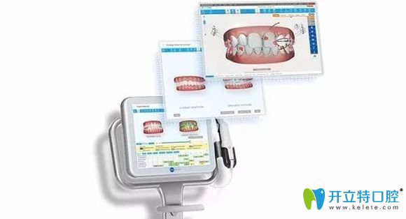 廣州柏德口腔口掃設(shè)備圖