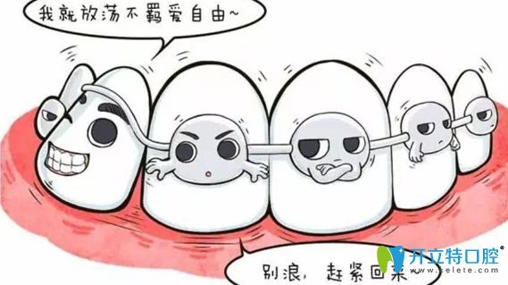 如果做的是單顆或兩顆烤瓷牙還可以矯正牙齒嗎