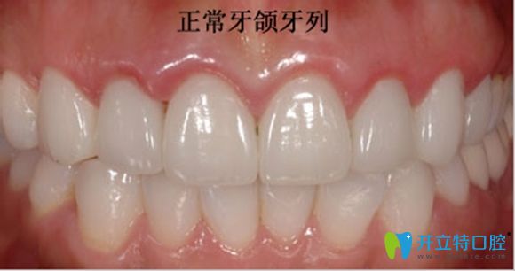 正常牙頜牙列示意圖