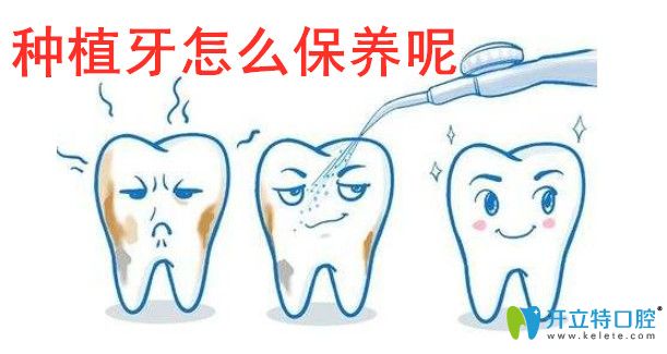 種植牙怎么保養(yǎng)才會使用更久