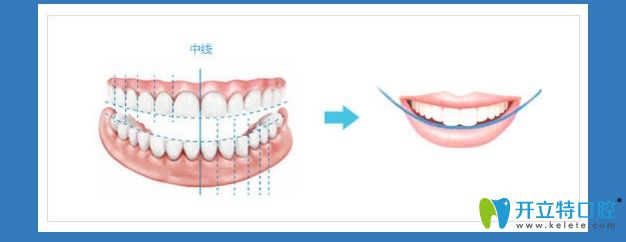 選擇虹橋做正畸的理由