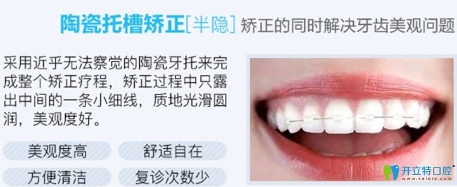 半隱形陶瓷托槽矯正價格