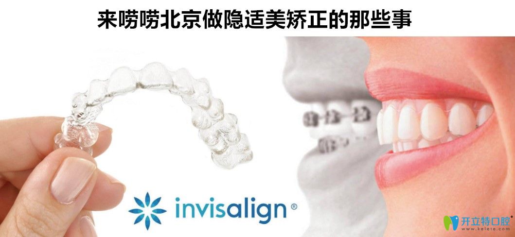 北京隱適美矯正哪家醫(yī)院比較好及北京隱適美牙套價(jià)格