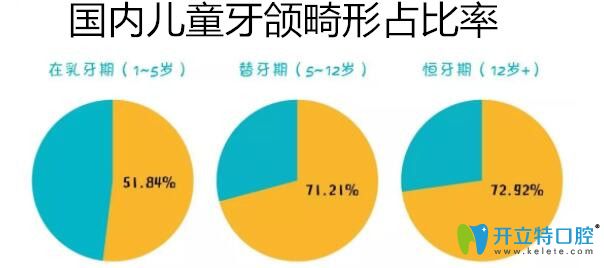  5種常見的牙頜畸形圖片和治療方法,值得收藏哦！