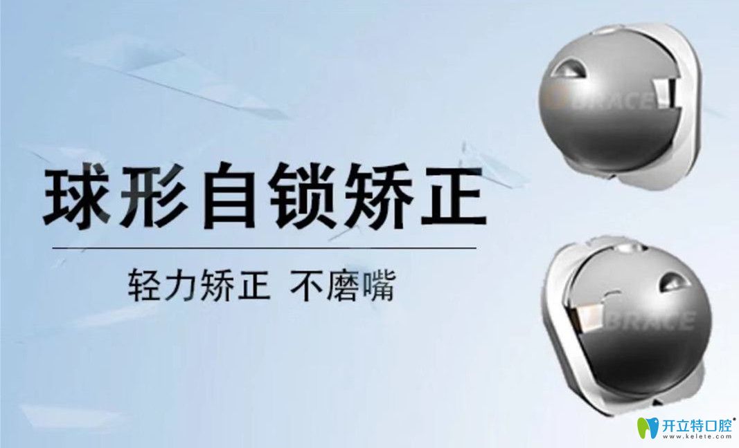 自鎖牙套的升級版球面自鎖矯正器