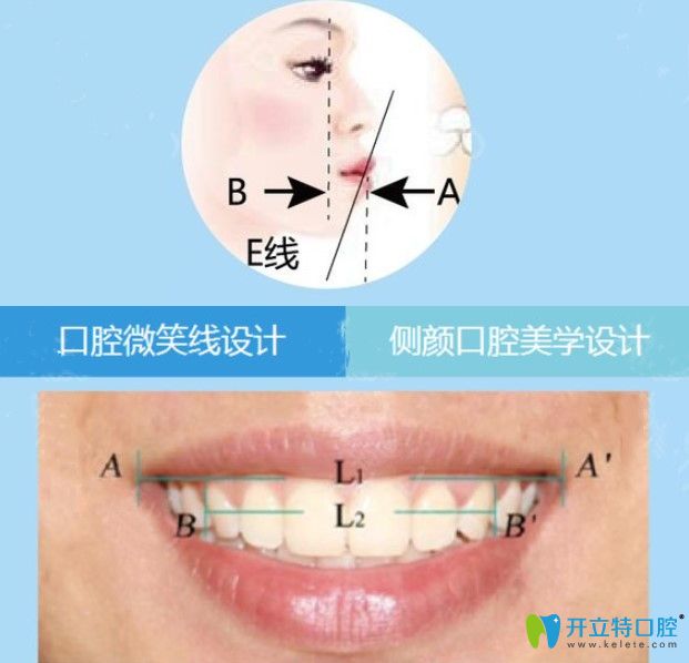 廣州美萊在正畸方面有獨到的美學標準