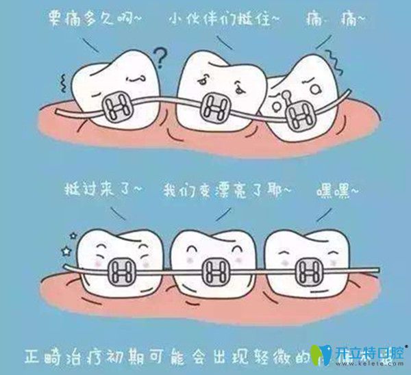 正畸的價格是多少