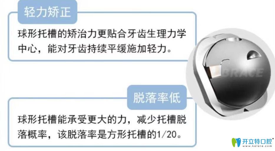 球面自鎖托槽矯正器優(yōu)勢