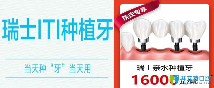 廣州廣大口腔瑞士ITI種植牙優(yōu)惠價(jià)格