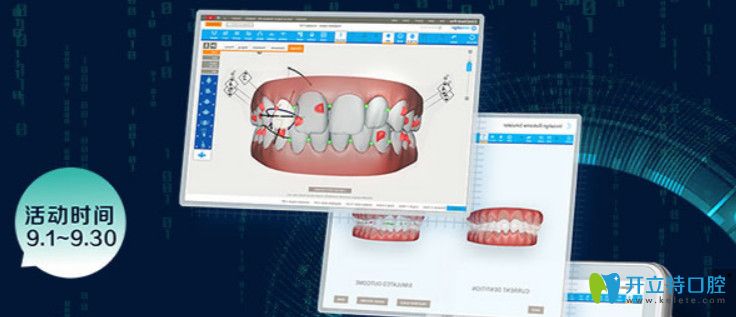 重慶團(tuán)圓口腔隱形矯正