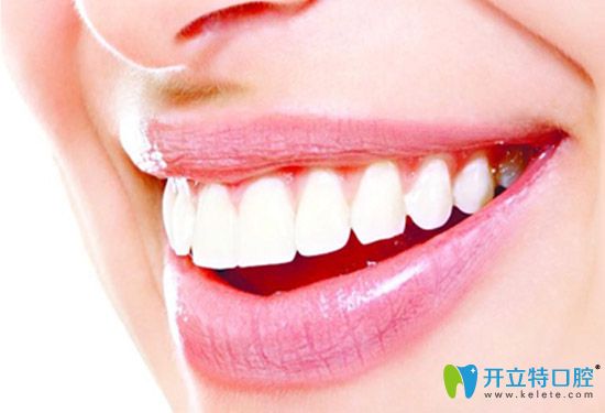 美萊口腔牙齒矯正后的樣子