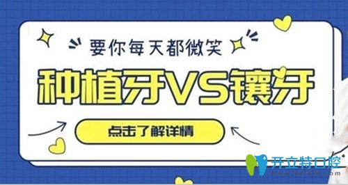 高昂醫(yī)生講解種植牙和鑲牙的優(yōu)點和缺點