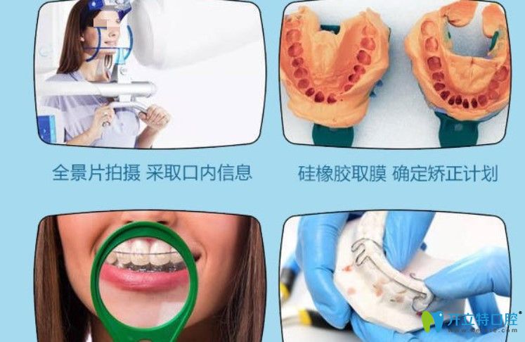 深圳格倫菲爾口腔做牙齒矯正的流程