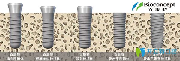 五種不同的百康特種植系統(tǒng)