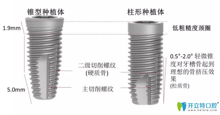 瑞典尼奧斯種植體型號