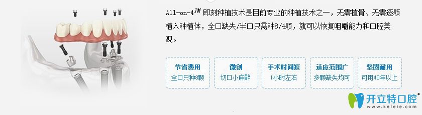 All-on-4即刻種植牙的簡(jiǎn)介及優(yōu)勢(shì)圖