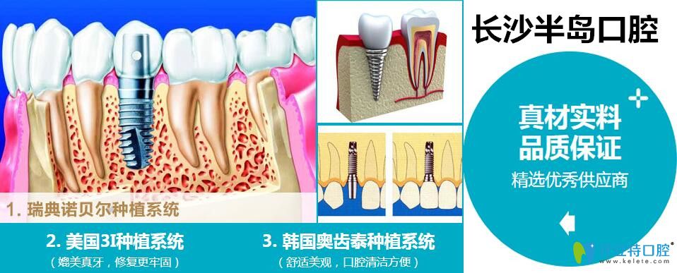 <!--<i data=20240703-sp></i>-->口腔種植牙