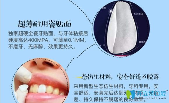 韋博口腔的E-max瓷貼面美白優(yōu)勢介紹圖