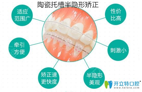 陶瓷托槽半隱形矯正圖 陶瓷托槽半隱形矯正圖