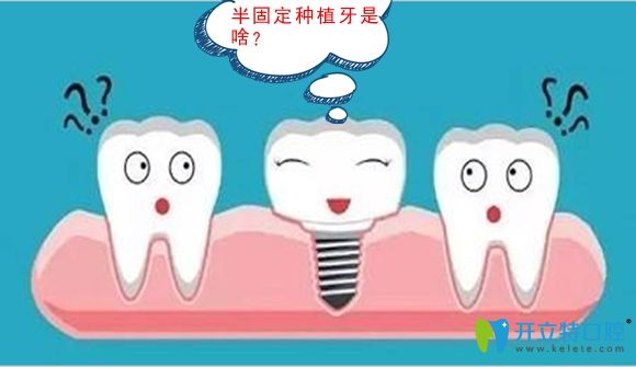 修復缺牙是選半口半固定種植牙還是固定種植好呢,區(qū)別在哪