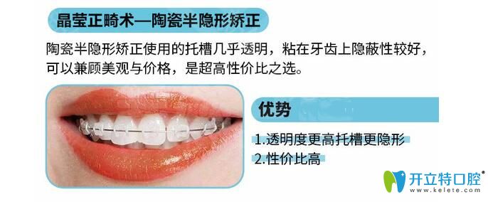 陶瓷托槽半隱形矯正優(yōu)勢 陶瓷托槽半隱形矯正優(yōu)勢