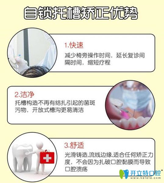 自鎖托槽矯正的優(yōu)勢(shì)