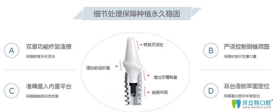 優(yōu)貝口腔的設(shè)備先進(jìn)細(xì)節(jié)處理到位