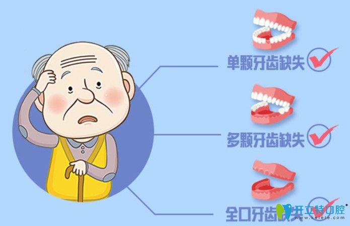 即刻種植牙價格表