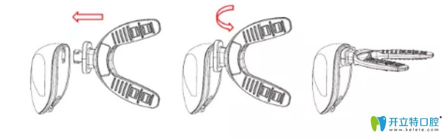 正畸加速器圖解