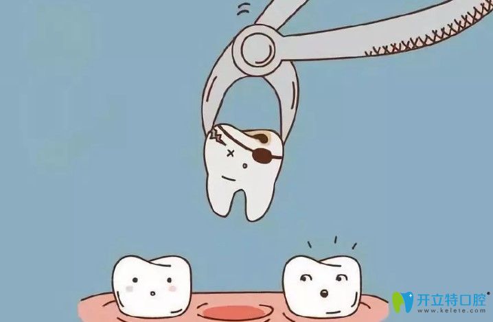 隱適美矯正齙牙拔了兩顆智齒