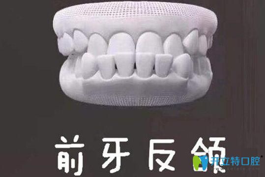 牙齒地包天能自我矯正嗎？牙齒反頜的矯正方法了解一下吧