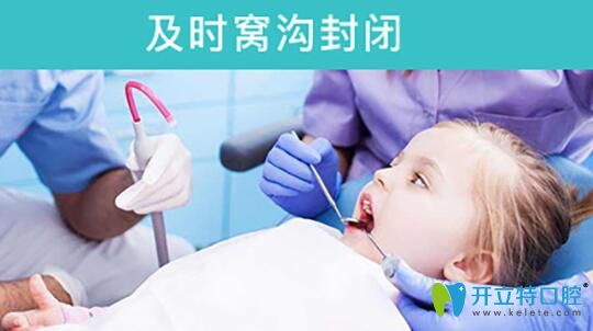 青島維樂萬琳介紹窩溝封閉