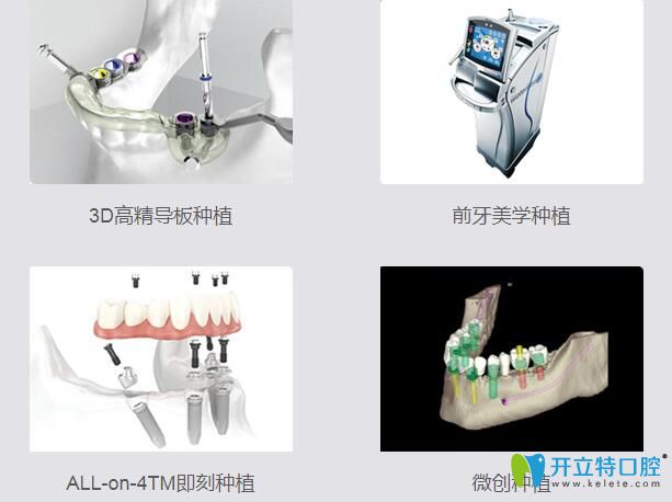 重慶美奧口腔4大種植技術(shù)