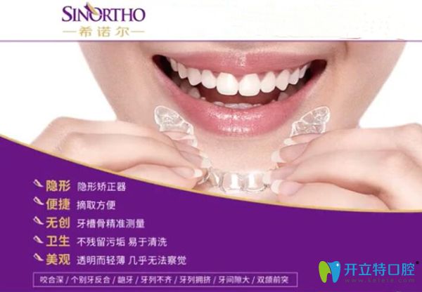 希諾爾隱形矯正優(yōu)點(diǎn)