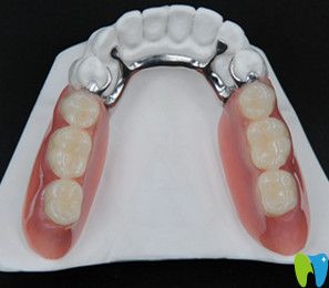 東營鉑爾口腔張小龍醫(yī)生介紹可摘戴局部義齒修復步驟 東營鉑爾口腔張小龍醫(yī)生介紹可摘戴局部義齒修復步驟