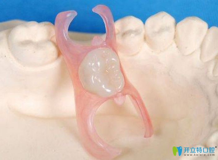 有些情況會導致全口活動義齒經(jīng)常脫落