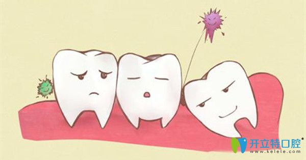 空間不足容易引發(fā)冠周炎 空間不足容易引發(fā)冠周炎