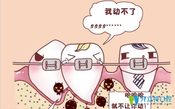 牙周病必須治療后才可以進(jìn)行正畸