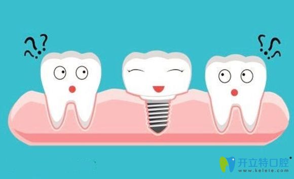 長沙種植牙多少錢一顆呢