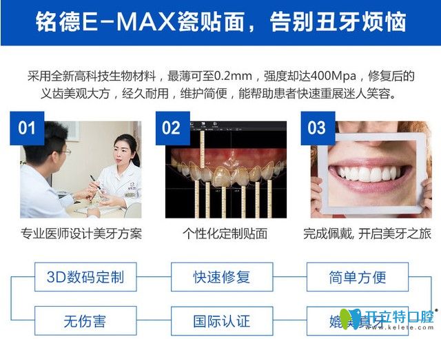 銘德E-MAX瓷貼面介紹