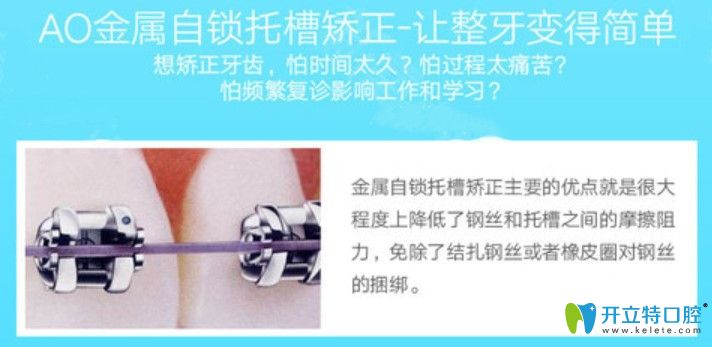 Ao自鎖托槽矯正優(yōu)勢