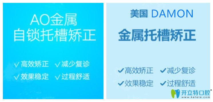 美國ao（美奧）與damon自鎖托槽矯正區(qū)別