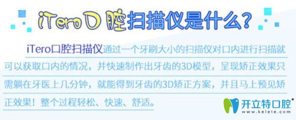 Itero口內掃描儀