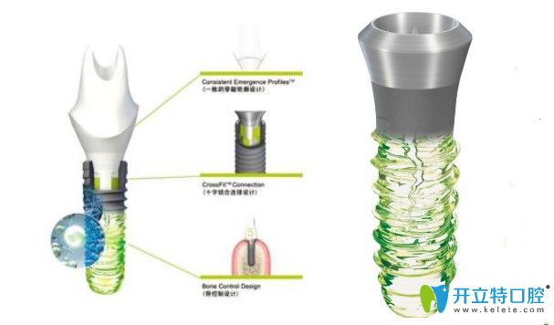 以色列雅定親水種植體和瑞士iti親水種植體相比哪個(gè)更好