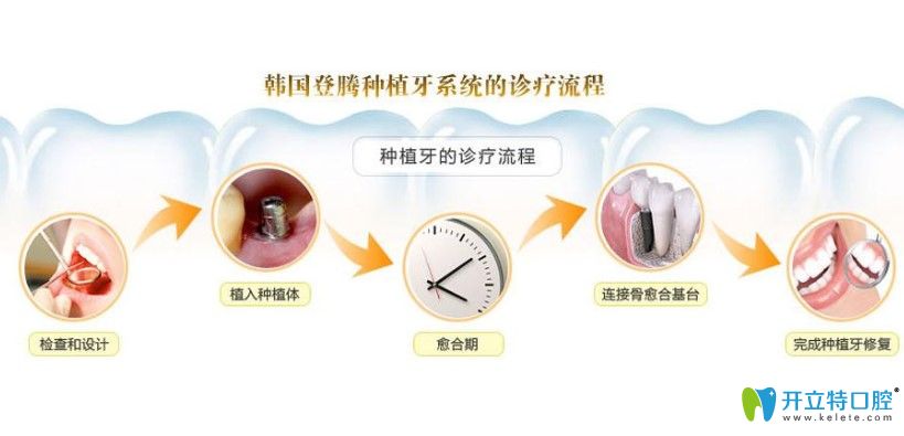 韓國(guó)登騰種植系統(tǒng)好不好