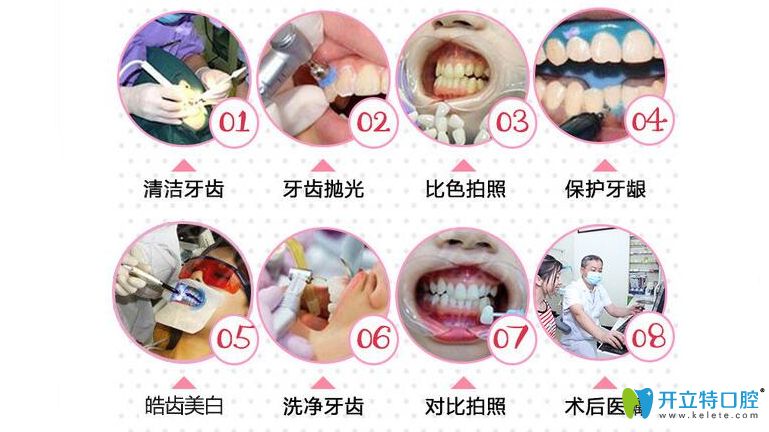 <!--<i data=20240703-sp></i>-->億大口腔皓齒美白操作流程