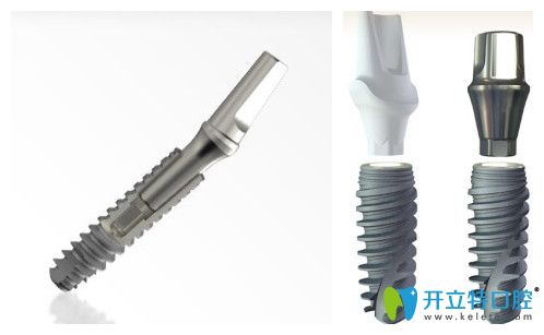 法國安卓健與諾貝爾種植體價格